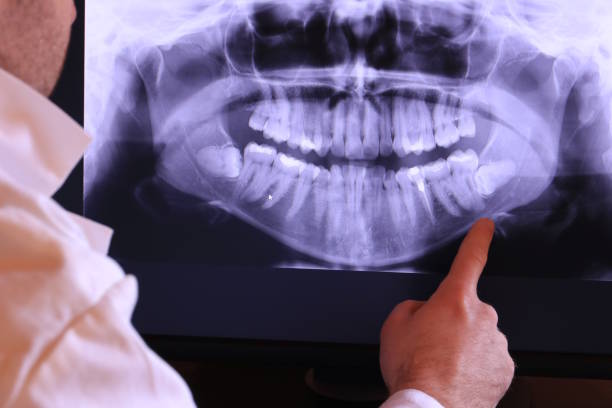 Best Emergency Dental Services for Seniors in Shiner, TX