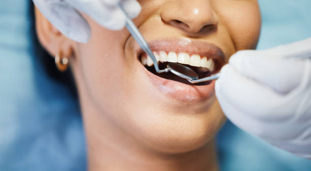 Best Emergency Dental Care for Abscessed Tooth in Shiner, TX